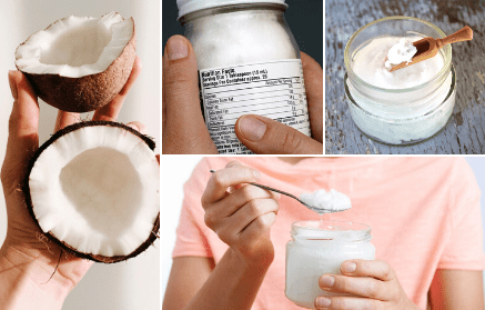 Coconut oil – super nutrition or super myth